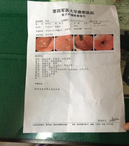 糜烂性胃炎